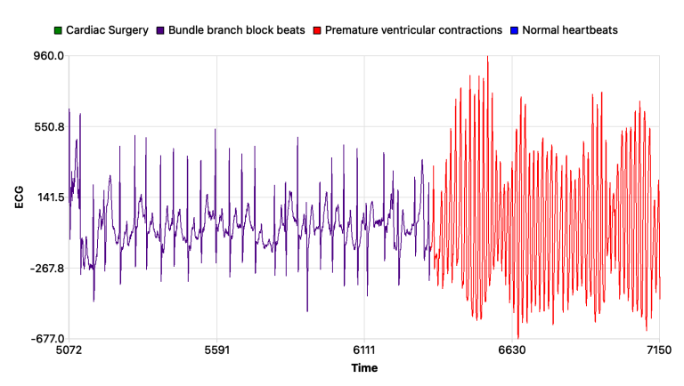 ECG Time Series